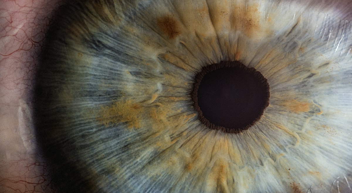 Macro photograph of a human eye showing the iris and cornea