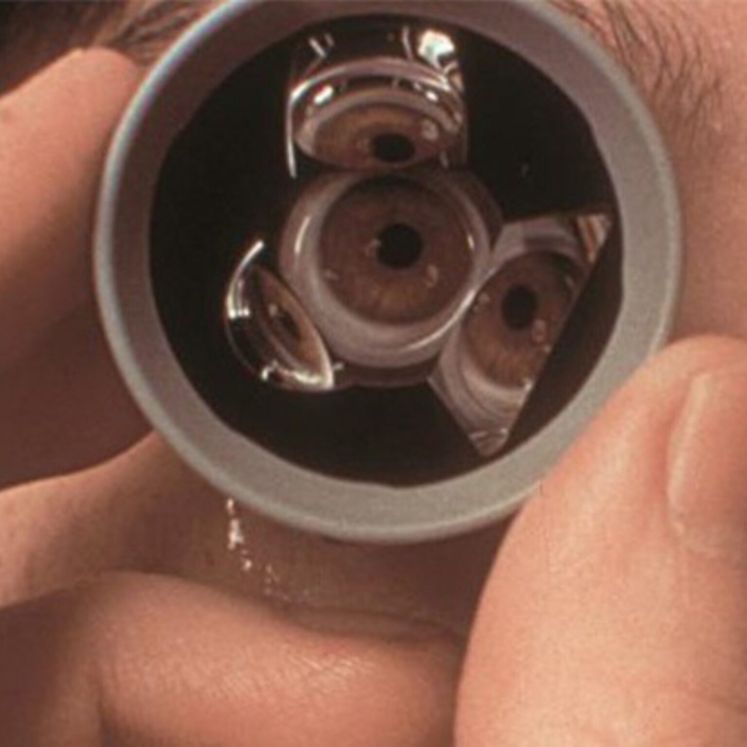 Digital Diagnostics Devices
