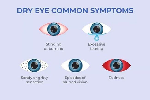 Dry Eye Treatment