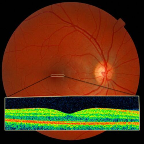 Retinal Imaging and Diagnosis at Trivision Eye Hospital