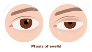 Treatment Image