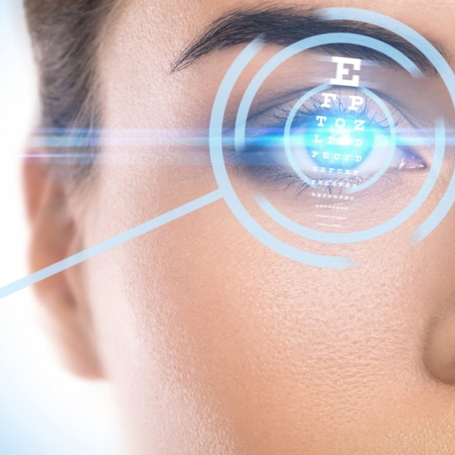 LASIK Eye Surgery Image