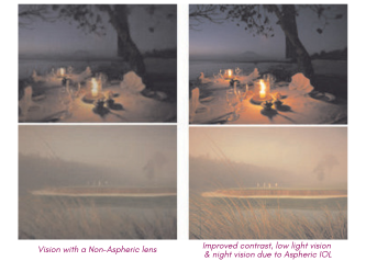 Types of Cataract Intraocular Lenses (IOL)