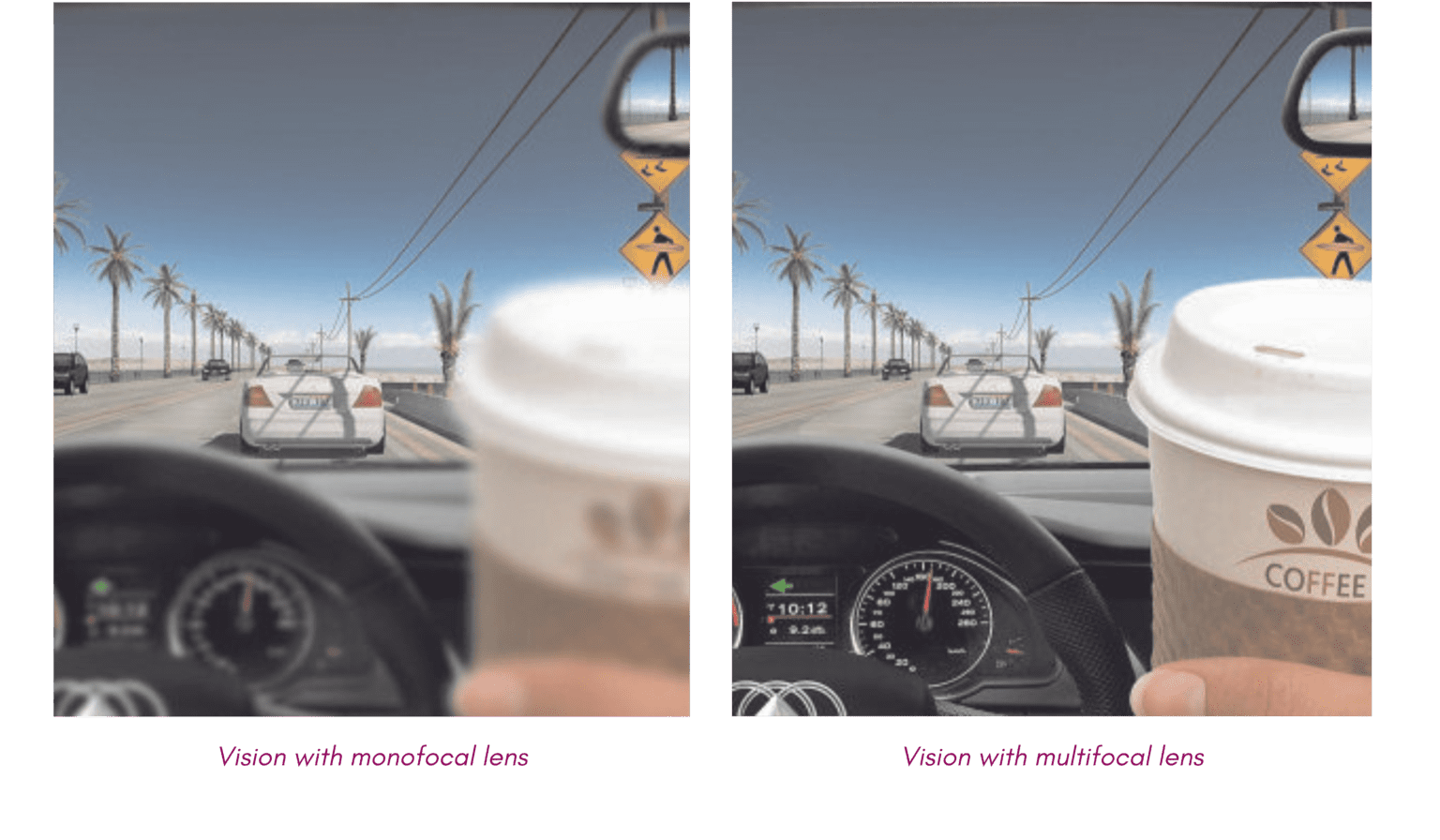 EDOF IOL for Extended Range Vision